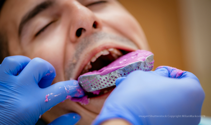 Intraoral Scanners dental oral