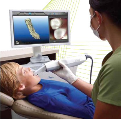Intraoral Scanners dental digital