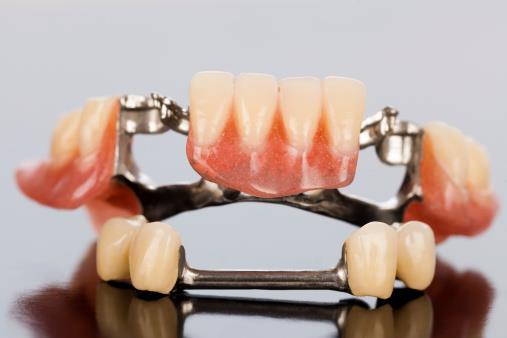partial dentures